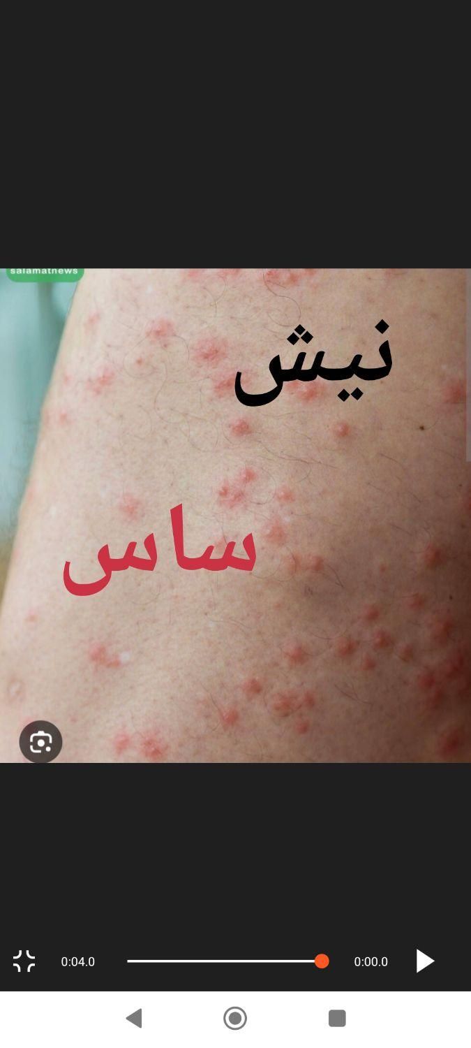 سمپاشی ساس سم پاشی سوسک در تمام نقاط تهران و حومه|خدمات نظافت|تهران, نارمک|دیوار
