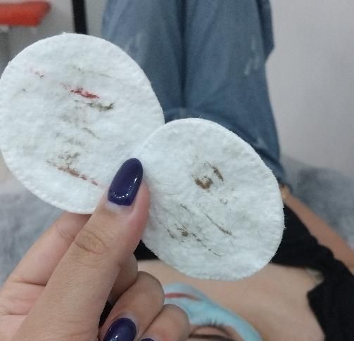 پاکسازی و جوانسازی پوست و‌ صورت|خدمات آرایشگری و زیبایی|بیرجند, |دیوار