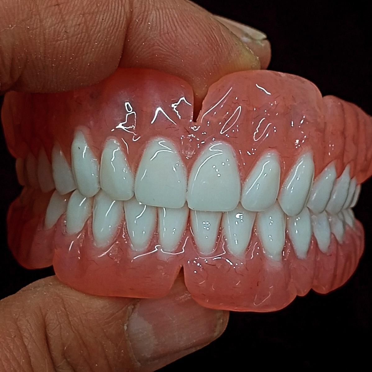 ساخت دندان مصنوعی اقساط با چک صیادی|خدمات آرایشگری و زیبایی|پردیس, فاز ۸|دیوار