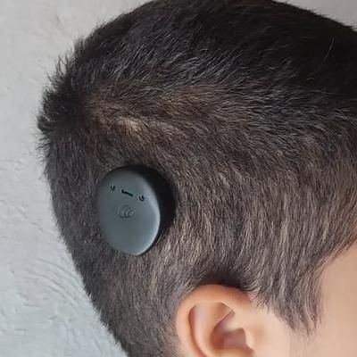 یک دستگاه کاشت حلزون شنوایی گم شده است|اشیا|مشهد, حرم مطهر رضوی|دیوار