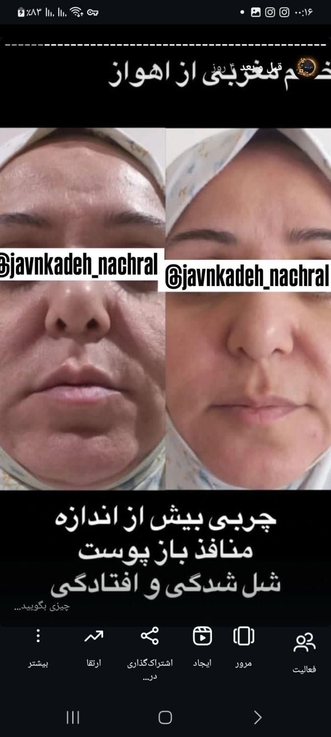 چین و چروک|آرایشی، بهداشتی، درمانی|تهران, جابری|دیوار