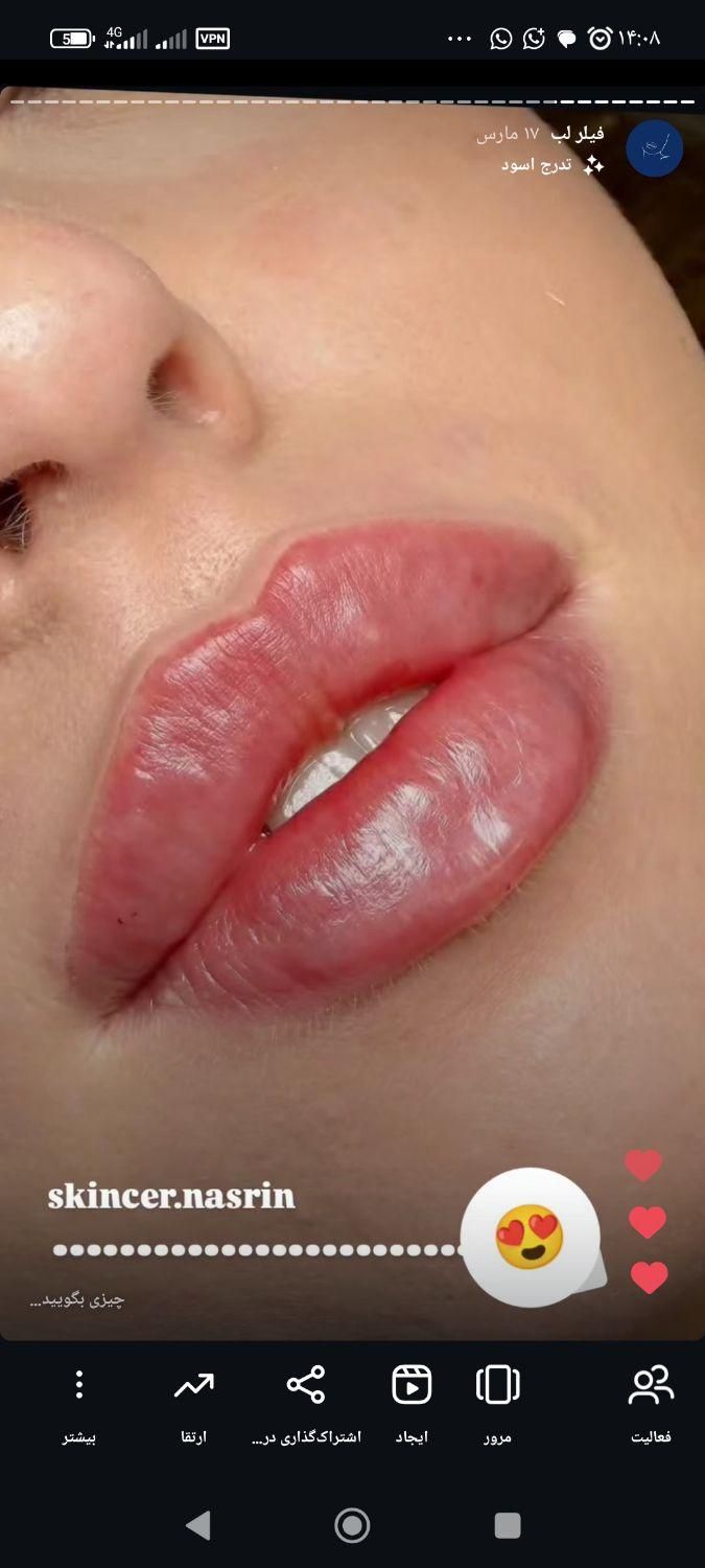 ورکشاپ اقتصادی مزوژل .مزوتراپی . بوتاکس|خدمات آموزشی|اصفهان, آبشار|دیوار