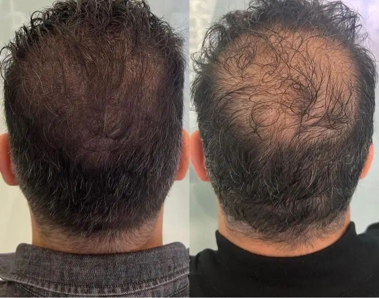 تونیک مو قطع ریزش رشد قوی رفع شوره وزی مو|آرایشی، بهداشتی، درمانی|آبادان, |دیوار