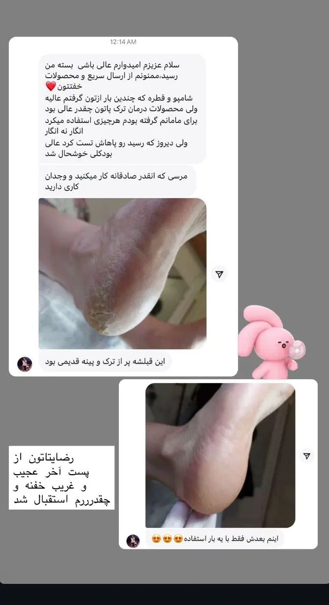 اسپری ترک پا و زانو راکو|آرایشی، بهداشتی، درمانی|اصفهان, جلفا|دیوار