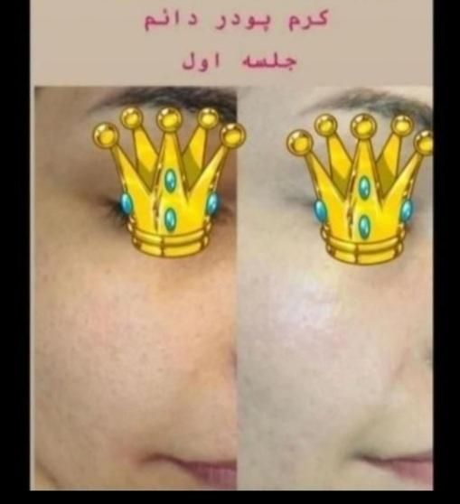 خدمات پاکسازی و جوانسازی پوست|خدمات آرایشگری و زیبایی|لاهیجان, مهرگان|دیوار