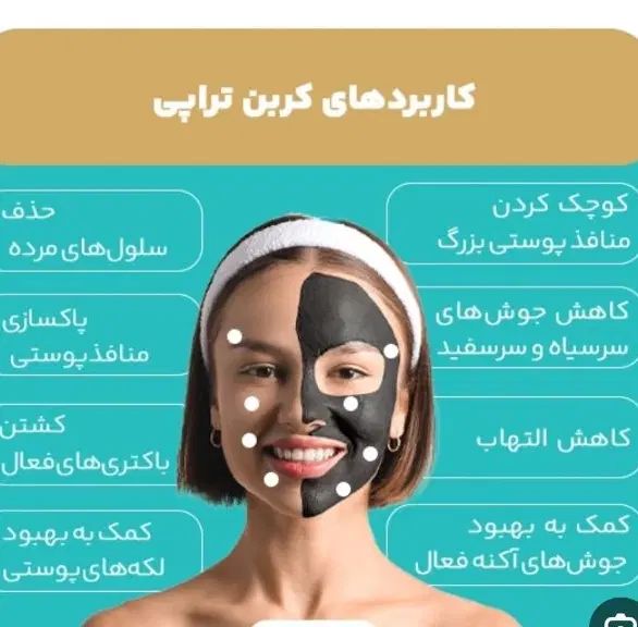 جلسه اول لیزر موهای زائد با کربن تراپی رایگان|خدمات آرایشگری و زیبایی|نجف‌آباد, شریعتی|دیوار