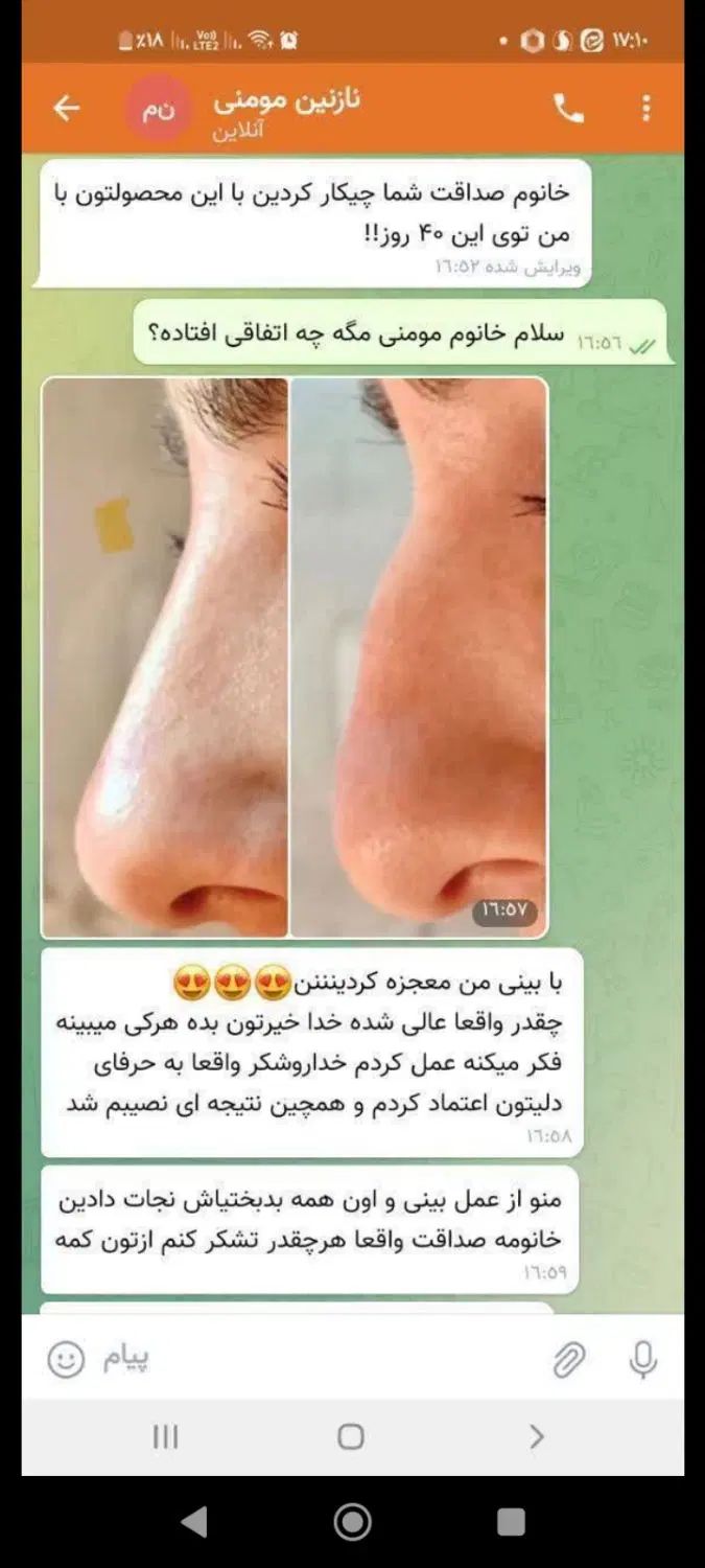 کرم لیفتینگ بینی|آرایشی، بهداشتی، درمانی|رشت, پل تالشان|دیوار
