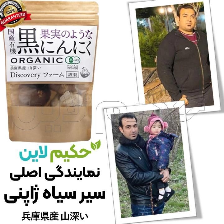کاهش وزن مخصوص شکم و پهلو بدون بازگشت|آرایشی، بهداشتی، درمانی|شیراز, چنچه|دیوار