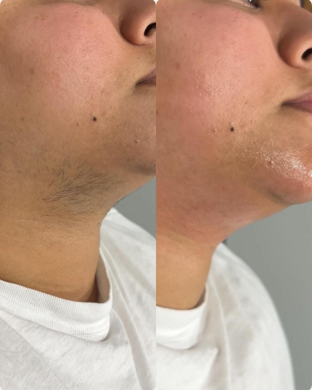 خانه لیزر صدراتضمینی|خدمات آرایشگری و زیبایی|صدرا-فارس, فاز ۱|دیوار