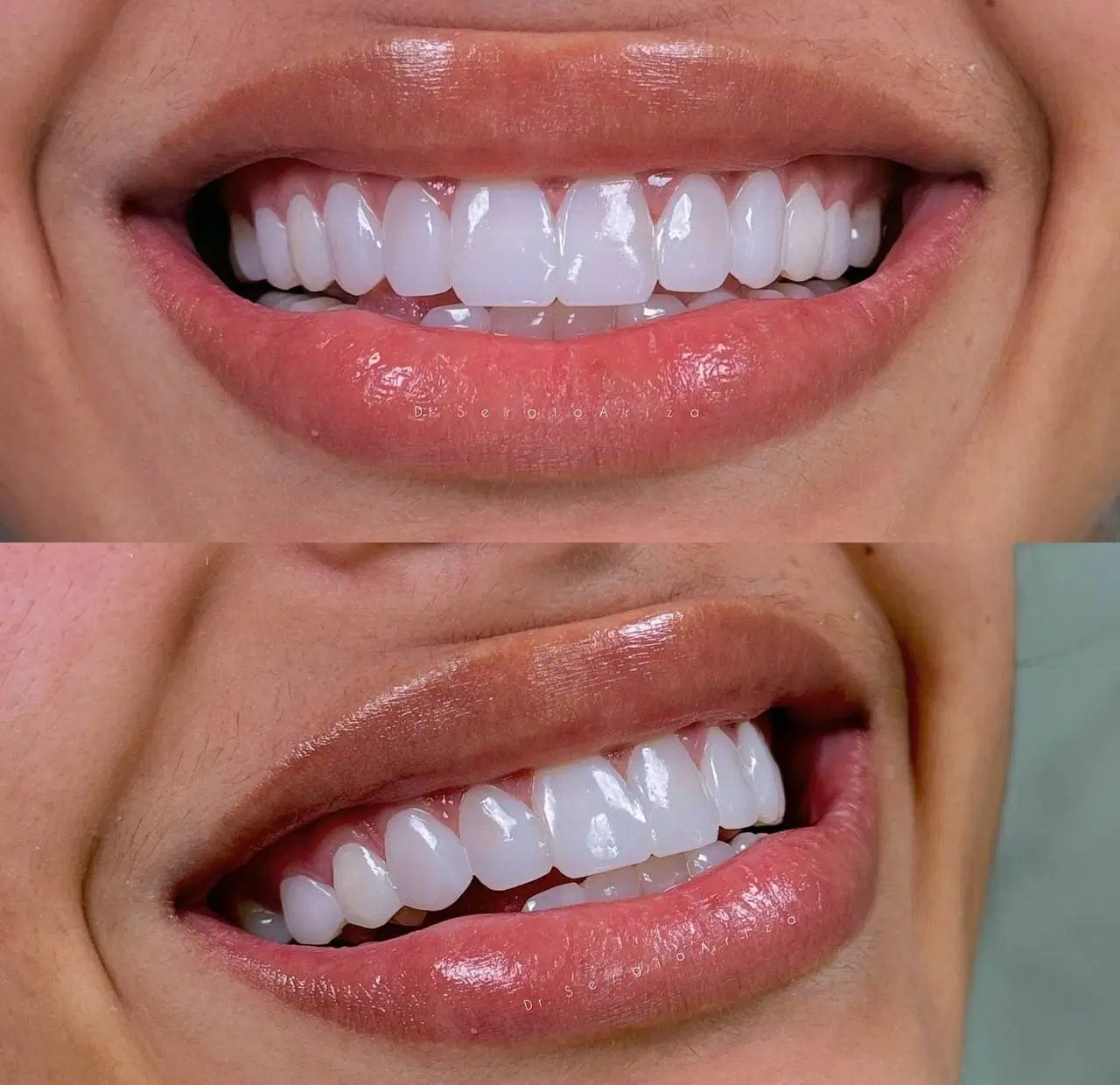 خدمات دندانپزشکی ازدم قسط/کامپوزیت/لمینت/روکش/|خدمات آرایشگری و زیبایی|تهران, سلسبیل شمالی|دیوار