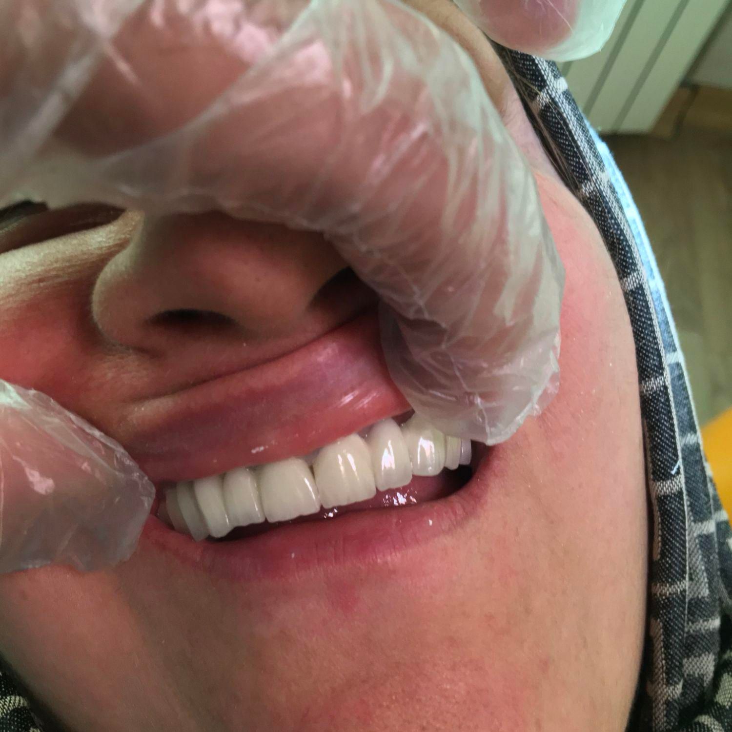 خدمات دندانپزشکی  مَستِر دِنت(اقساط)|خدمات آرایشگری و زیبایی|ارومیه, |دیوار