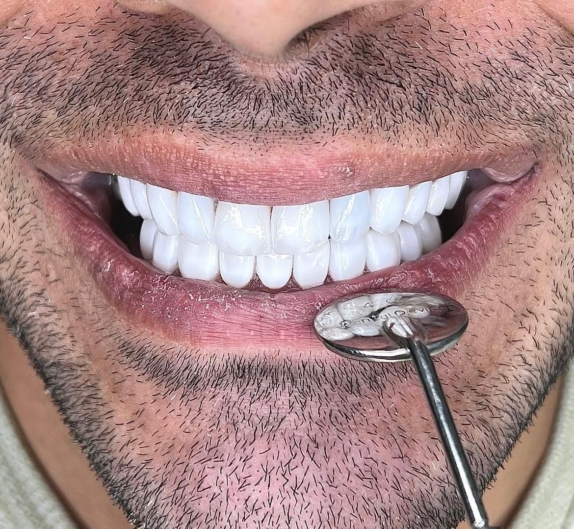 اموزش کامپوزیت ۱۰ میلیون|خدمات آموزشی|تهران, ترمینال غرب|دیوار