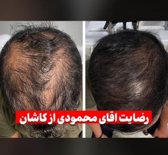محلول گیاهی ضد ریزش مو و رویش مجدد|آرایشی، بهداشتی، درمانی|شیراز, بهارستان|دیوار