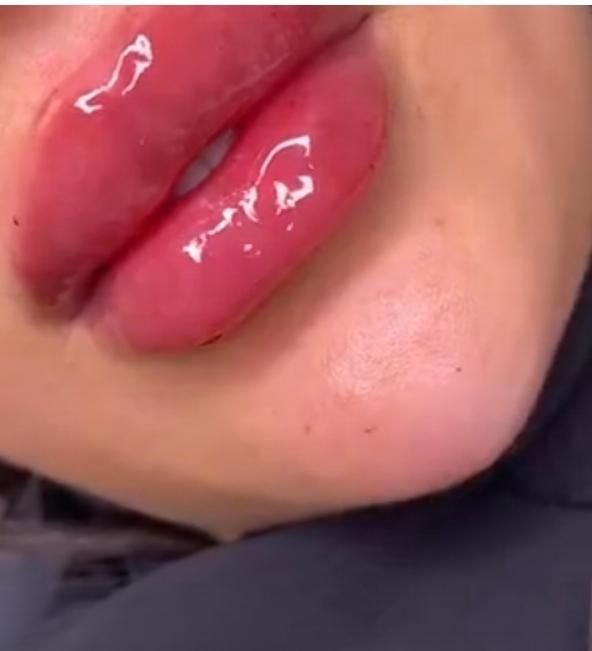 مدل ژل لب وبوتاکس فیلروغیره|خدمات آرایشگری و زیبایی|اسلام‌شهر, شهرک توحید|دیوار