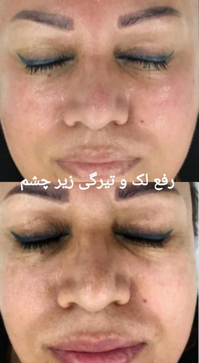 جشنواره تخفیفات کلینیک پوست همراه با هدیه|خدمات آرایشگری و زیبایی|مشهد, کوه سنگی|دیوار