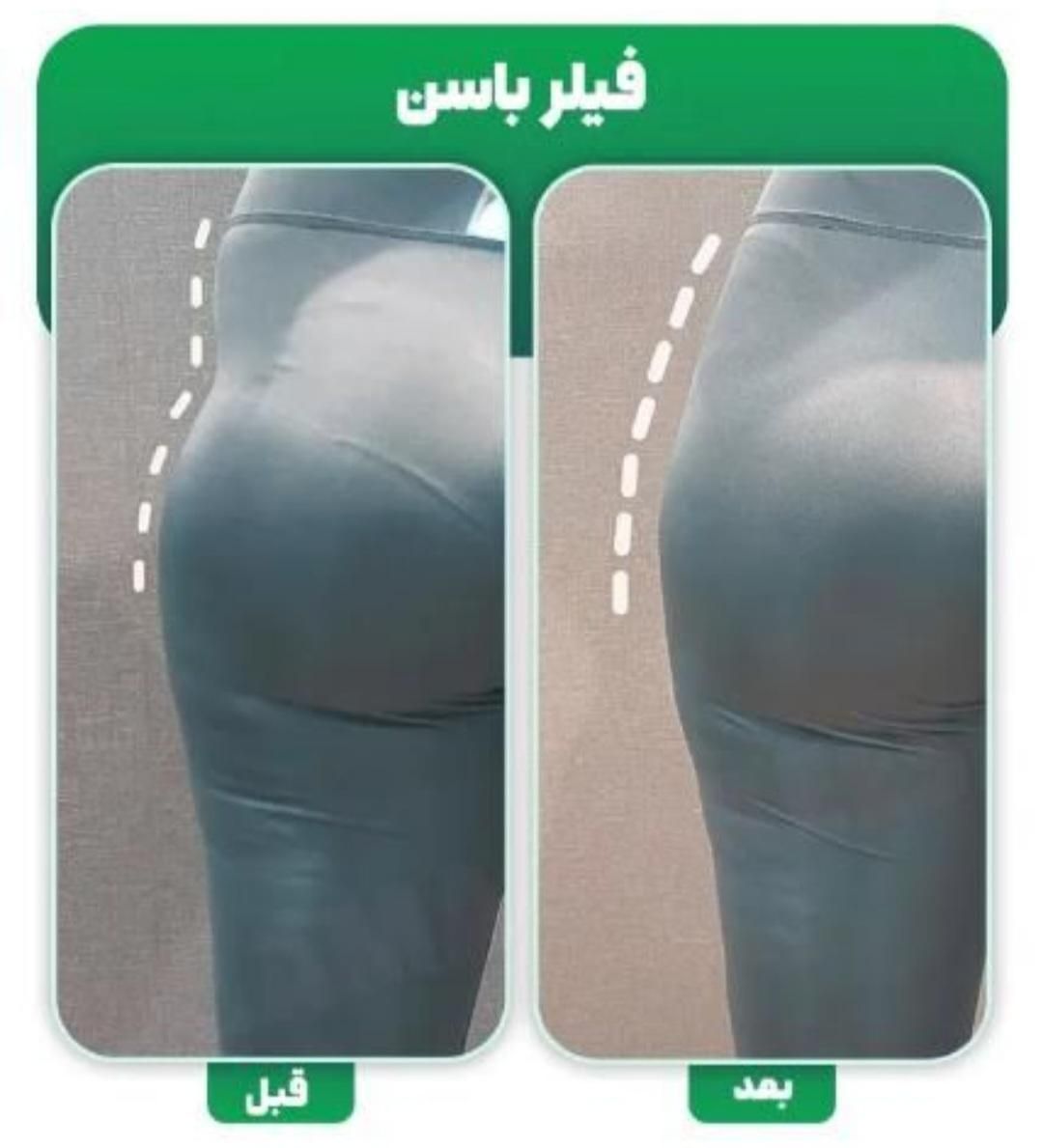 مدل هیپ دیپ  نخ صورت|خدمات آرایشگری و زیبایی|تهران, مرزداران|دیوار