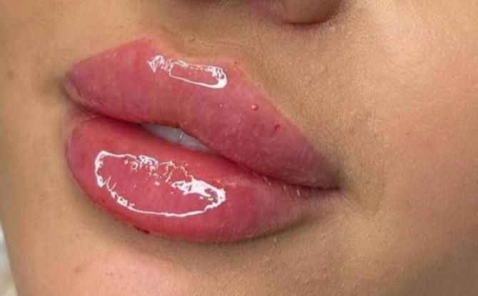 ژل فیلر آنزیم بوتاکس ناخن|خدمات آرایشگری و زیبایی|مرودشت, فرهنگ|دیوار