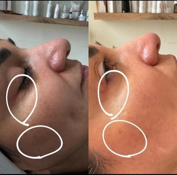آفر ویژه آموزش وخدمات تخصصی پاکسازی، فیشال(فیشیال)|خدمات آرایشگری و زیبایی|قم, باجک یک|دیوار