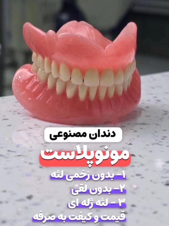 دندان مصنوعی اقساطی|خدمات آرایشگری و زیبایی|تهران, جهاد|دیوار