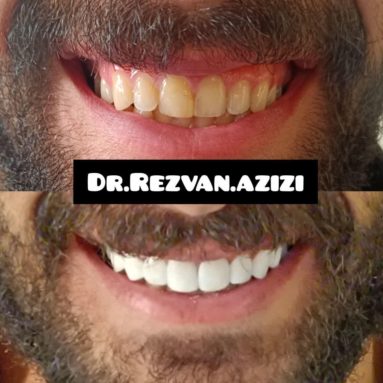 دیگر نگران هزینه‌های سنگین خدمات دندانپزشکی نباشید|خدمات آرایشگری و زیبایی|شیراز, ملاصدرا|دیوار