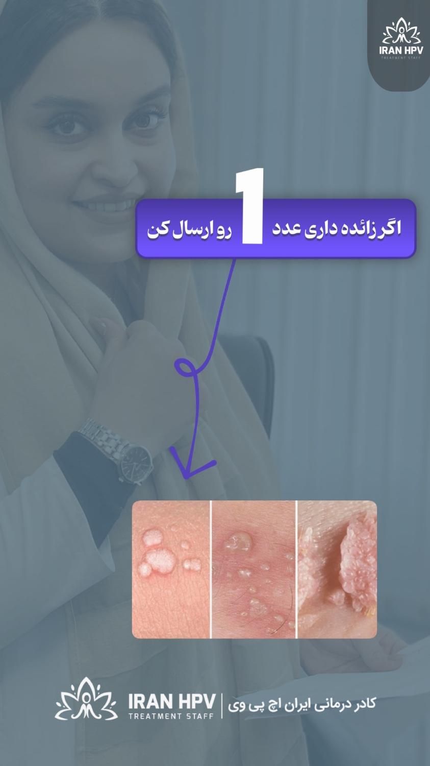 رفع زگیل و تبخال|آرایشی، بهداشتی، درمانی|مشهد, پایین خیابان|دیوار