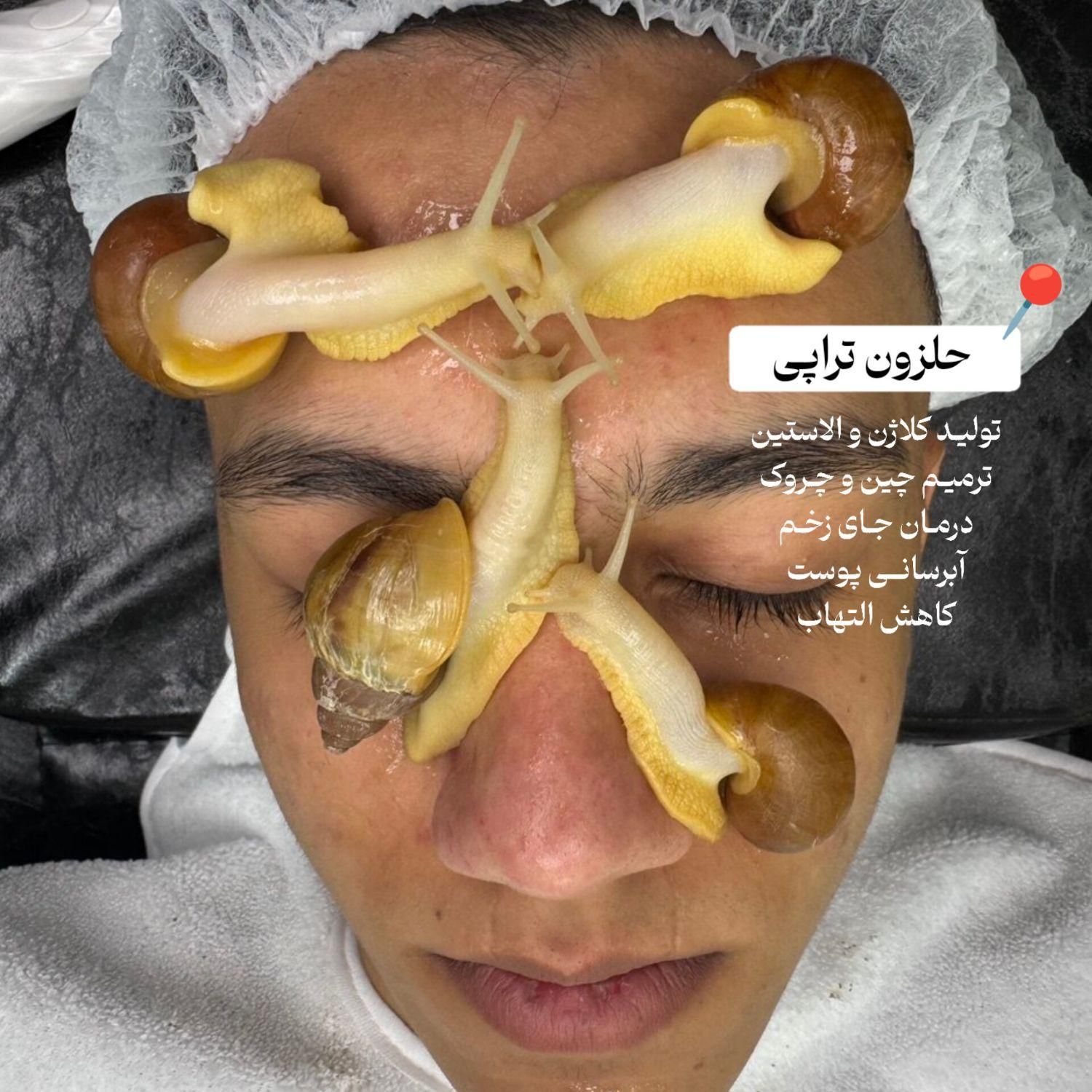 فیشیال تخصصی آقایان « پاکسازی پوست » فشیال فیشال|خدمات آرایشگری و زیبایی|مشهد, الهیه|دیوار