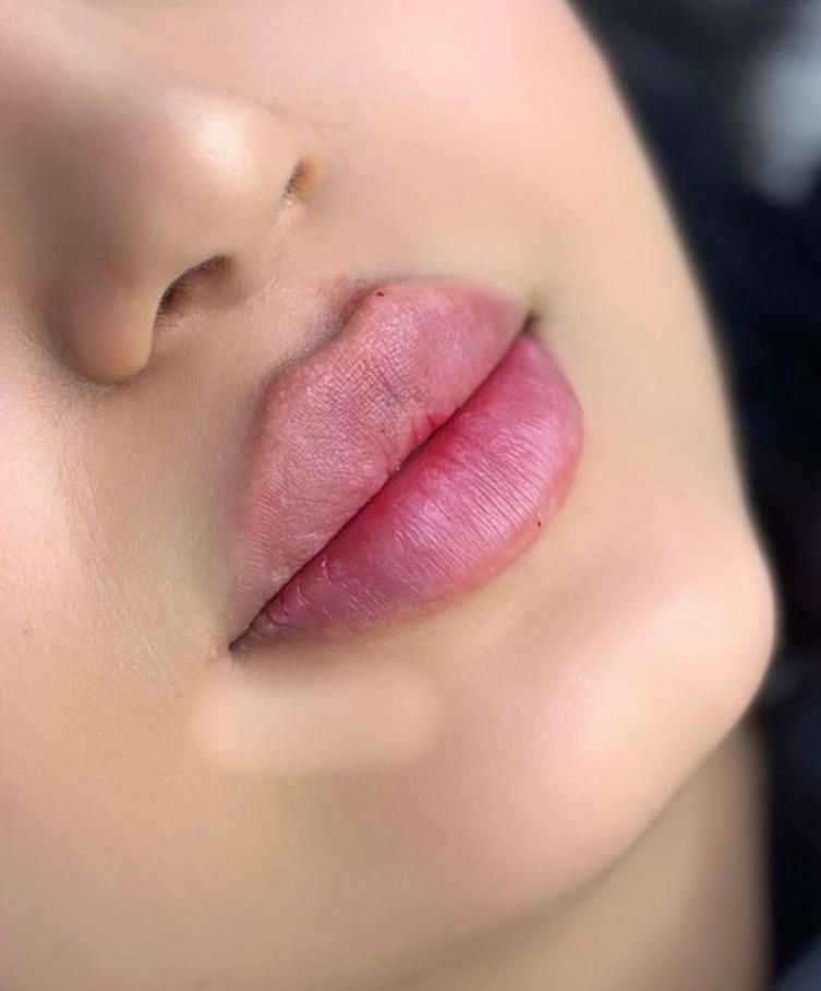 ژل لب روسی وبوتاکس ،لیفت نخ ،مزو ژل ،بلفارو بوکال،|خدمات آرایشگری و زیبایی|تهران, صادقیه|دیوار