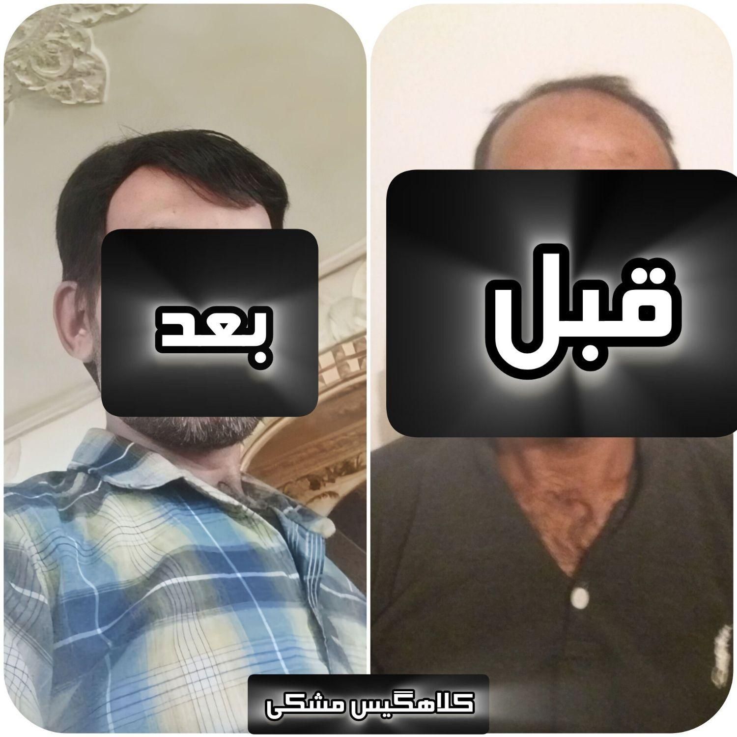 کلاهگیس مردانه زنانه الیافی و طبیعی مشهد|آرایشی، بهداشتی، درمانی|مشهد, عبادی|دیوار