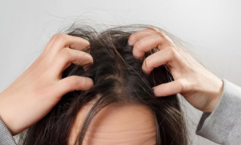 درمان صدرصدقطعی وتضمینی شپش ورشک برای همیشه|آرایشی، بهداشتی، درمانی|نورآباد, |دیوار