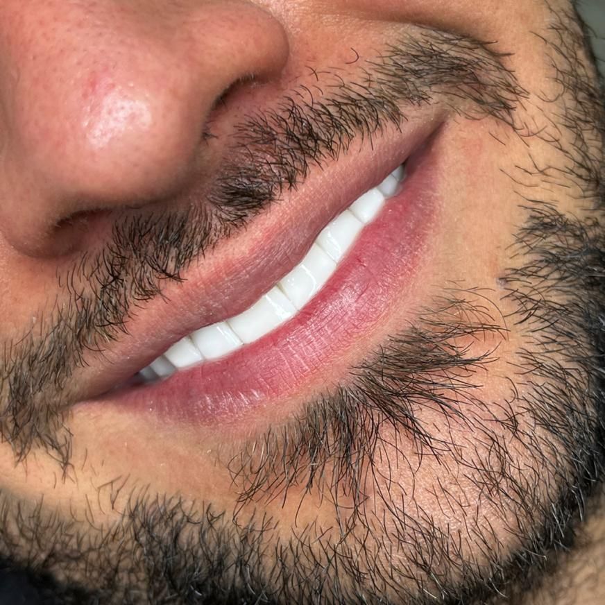 دندانپزشکی/لمینیت/ایمپلنت ( نصف قیمت تعرفه )|خدمات آرایشگری و زیبایی|تهران, فلسطین (میدان انقلاب)|دیوار