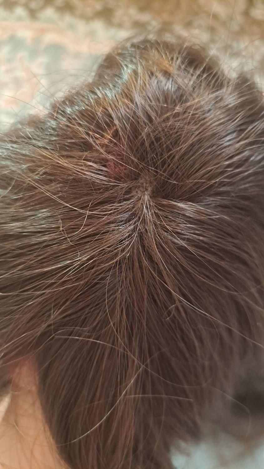 کلاه گیس|آرایشی، بهداشتی، درمانی|رشت, یخسازی|دیوار