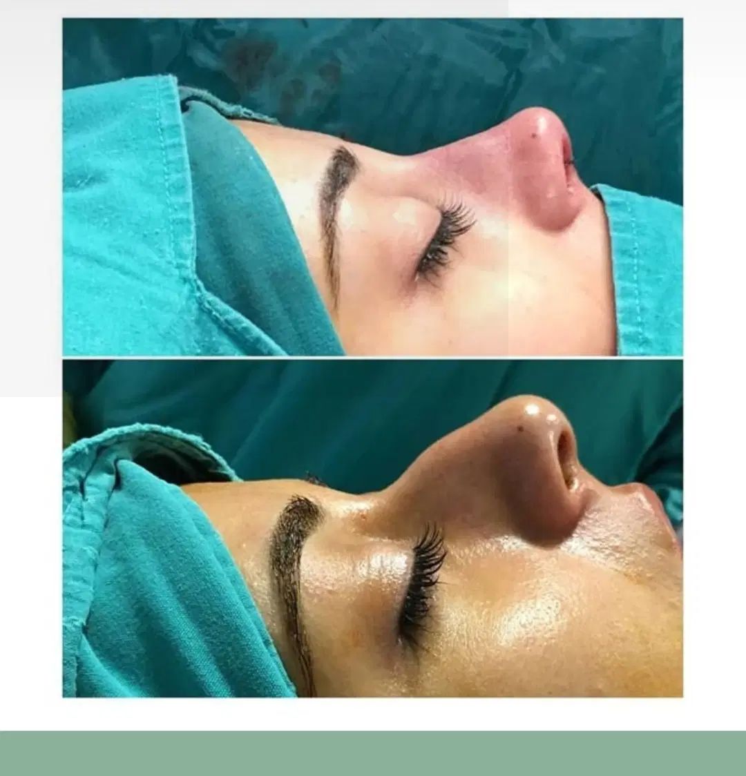 دندانپزشکی.کاشت مو.عمل بینی را دم قسط انجام بدهید|خدمات آرایشگری و زیبایی|بوشهر, |دیوار
