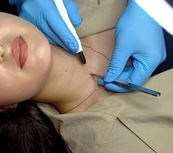 حذف ریمو تخصصی تتو و خالکوبی بدن و ابر با لیزر|خدمات آرایشگری و زیبایی|ارومیه, |دیوار