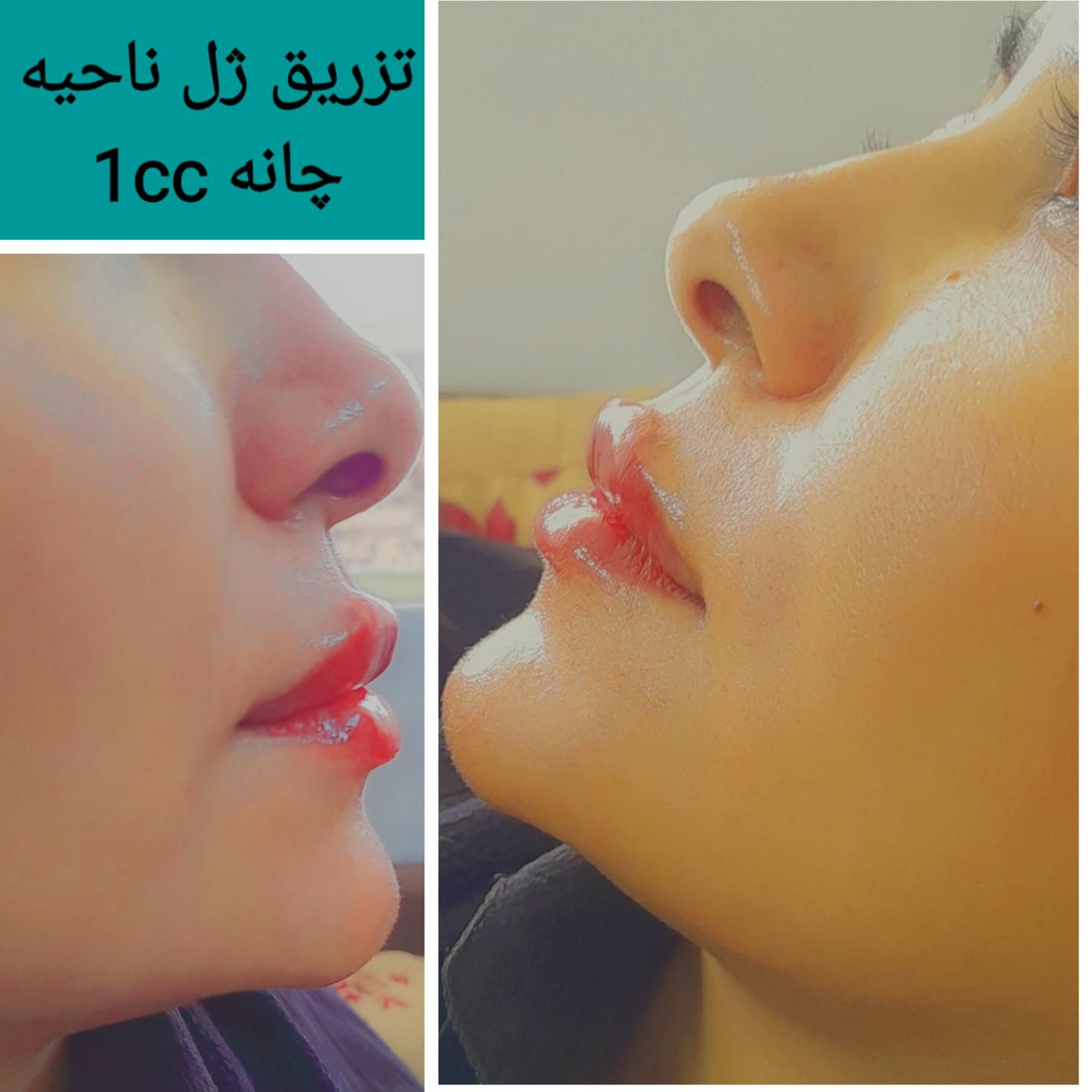 دستان هنرمندم زیبایی های نامرئی رابه نمایش میگذارد|خدمات آرایشگری و زیبایی|جهرم, |دیوار