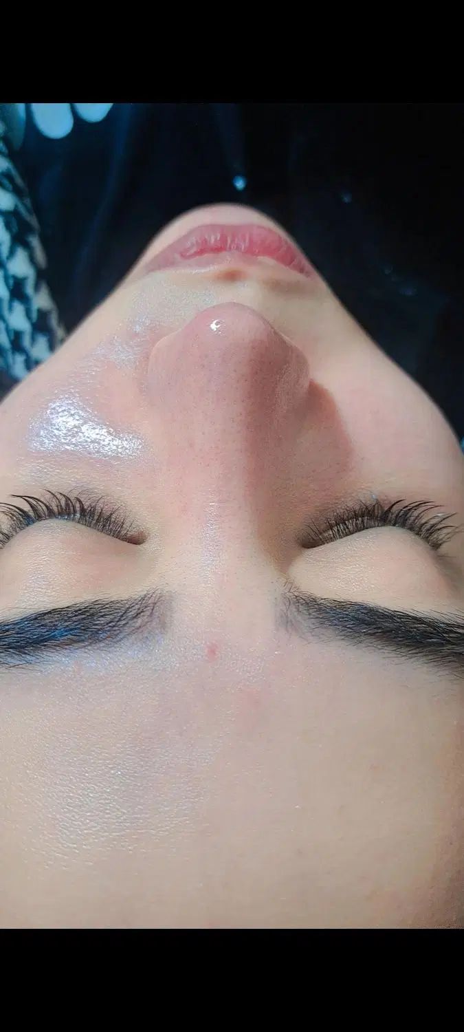 فیشال وپاکسازی تخصصی پوست|خدمات آرایشگری و زیبایی|مشهد, طلاب|دیوار