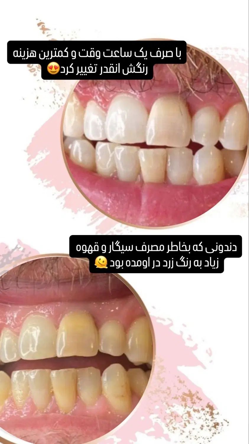 تخفیف خدمات دندانپزشکی و شرایط پرداخت اقساط|خدمات آرایشگری و زیبایی|رشت, گلسار|دیوار