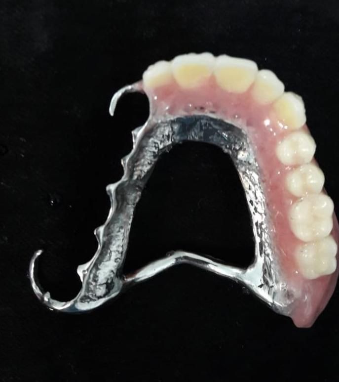 دندانسازی|خدمات آرایشگری و زیبایی|اقلید, |دیوار