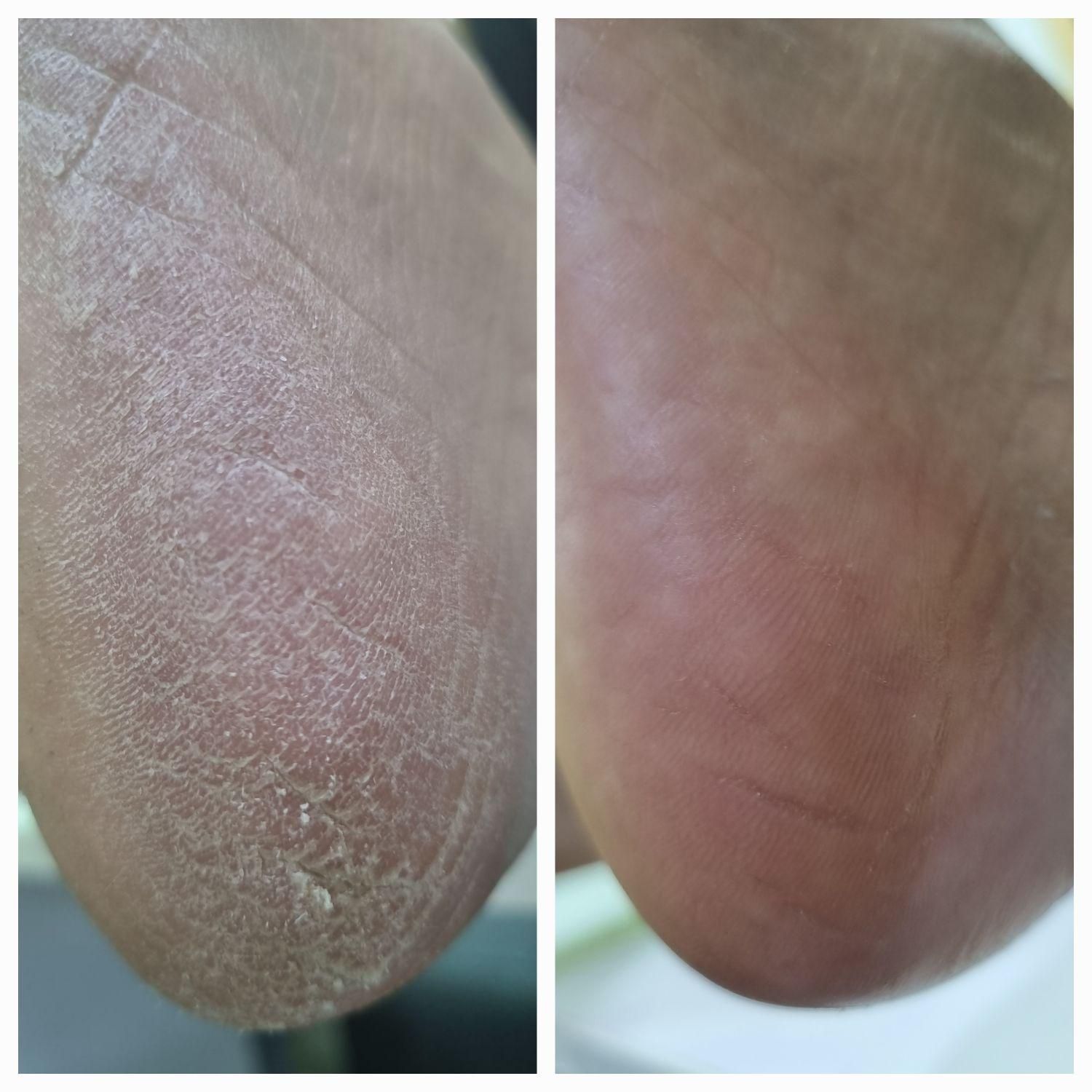 پدیکور و کف سابی|خدمات آرایشگری و زیبایی|رشت, بوسار|دیوار