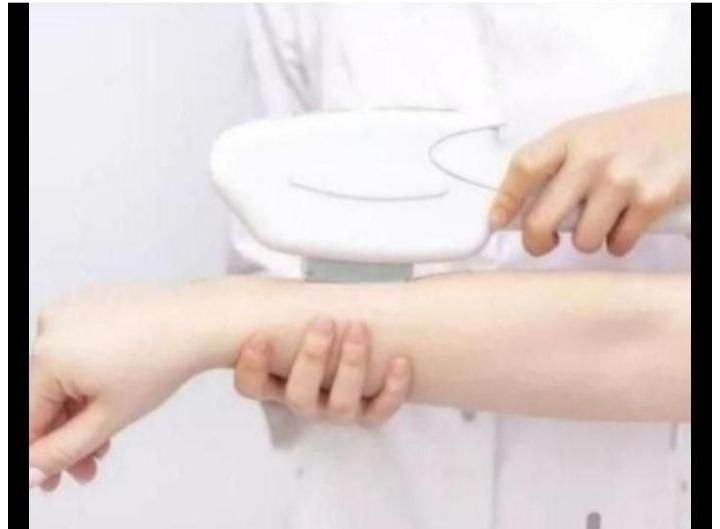 لیزر موهای زائد|خدمات آرایشگری و زیبایی|لاهیجان, کوی خزر|دیوار