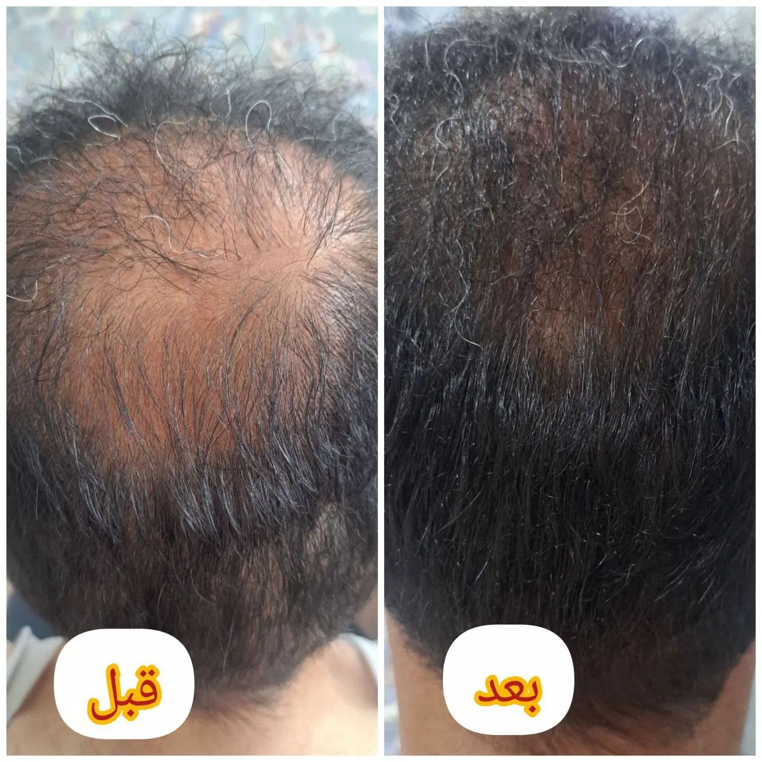 روغن معجزه اکسیر مو|آرایشی، بهداشتی، درمانی|مشهد, شهرک بهارستان|دیوار