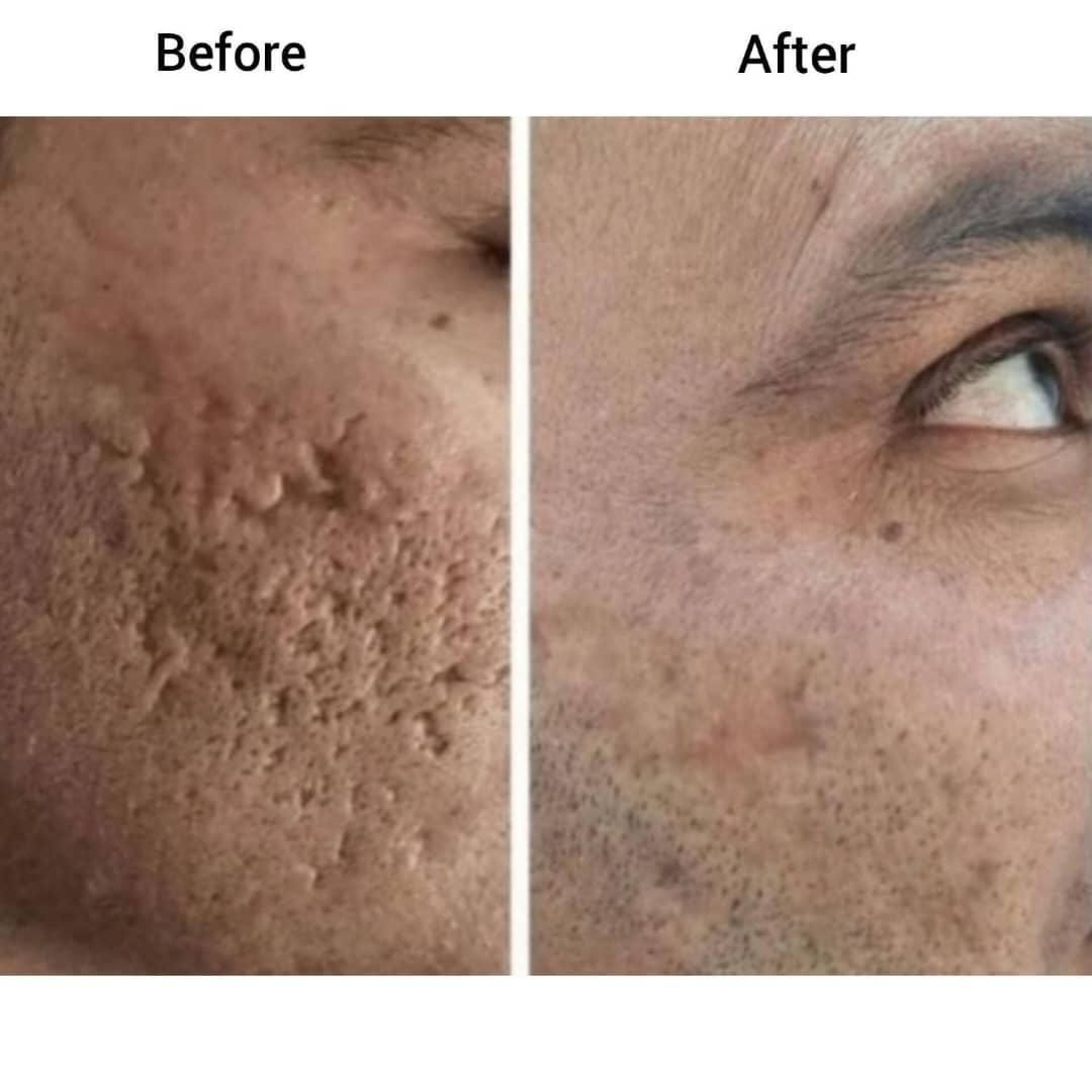 فیشیال و درمان عارضه های پوستی|خدمات آرایشگری و زیبایی|اصفهان, محله اسلامی|دیوار