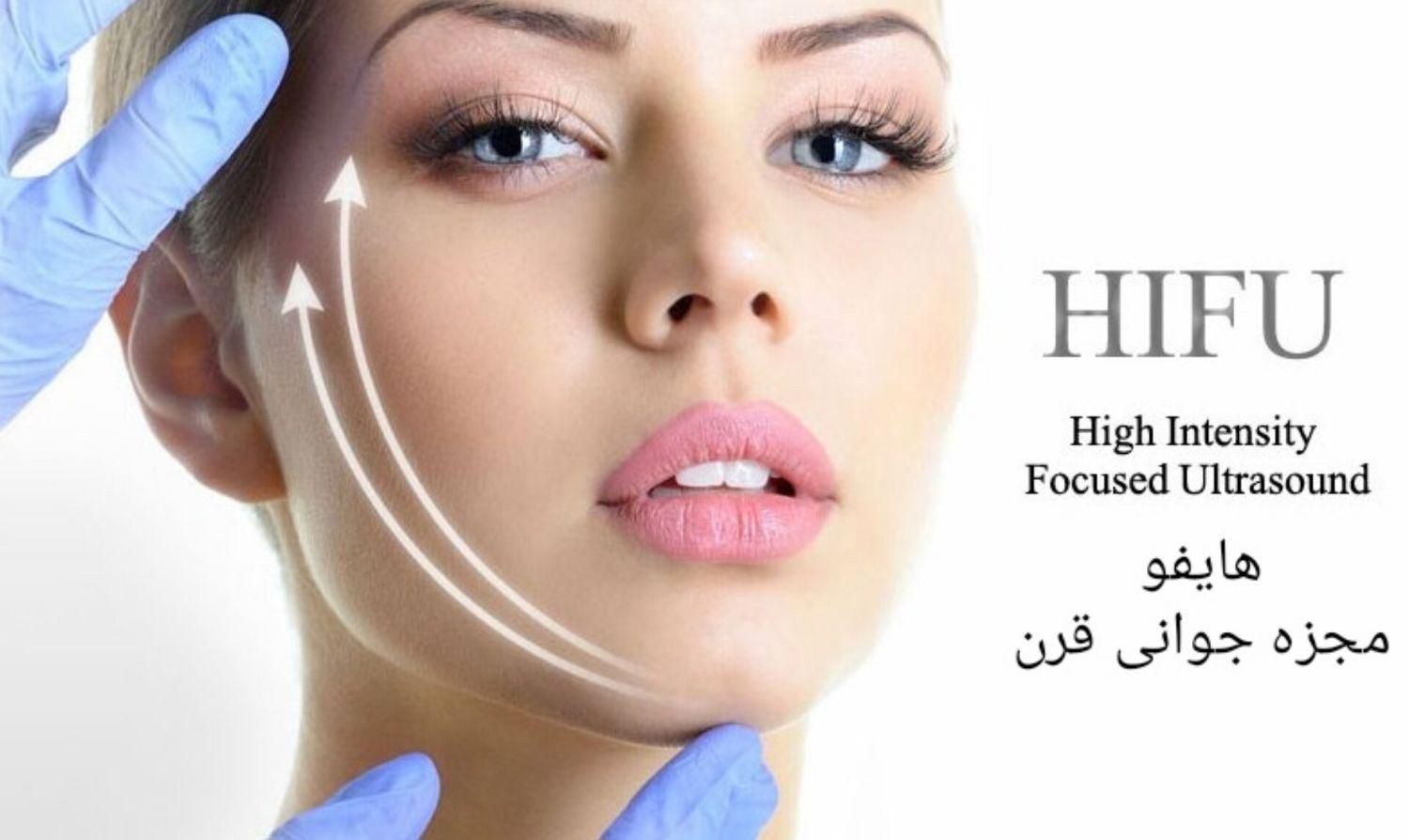 لابیا، تنگی ،ترمیم ،لاغری بدن ،لیفت صورت با هایفو|خدمات آرایشگری و زیبایی|شیراز, ارم|دیوار