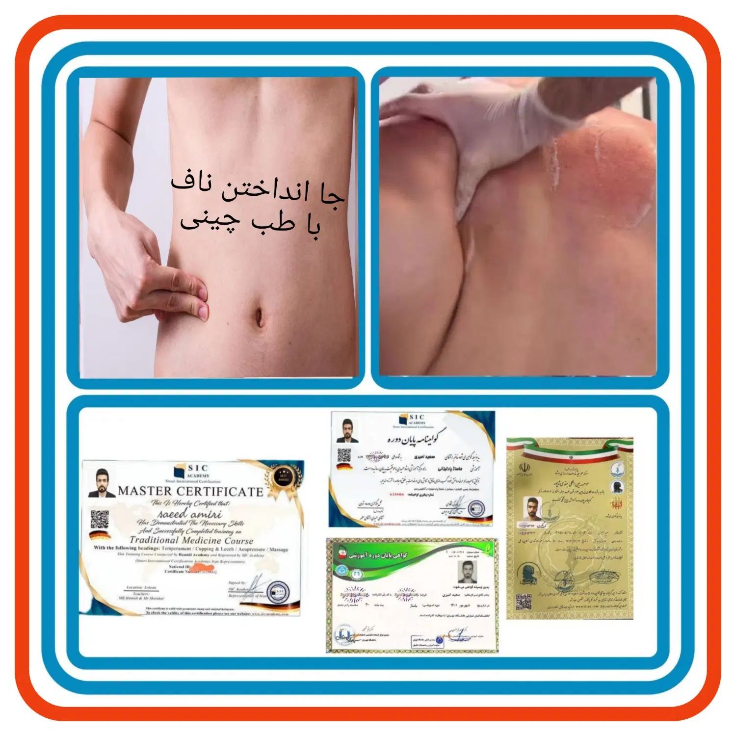 حجامت/بادکش/زالو/ناف گیر/ماساژدرمانی درمنـزل شـما|خدمات آرایشگری و زیبایی|کرمانشاه, |دیوار