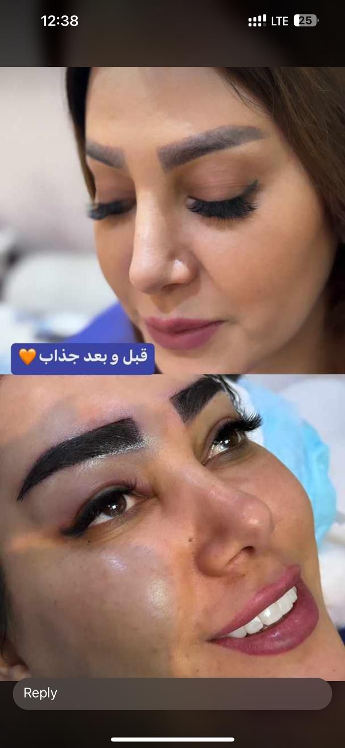 کاشت مو/ابرو /ریش|خدمات آرایشگری و زیبایی|شیراز, قدوسی غربی|دیوار