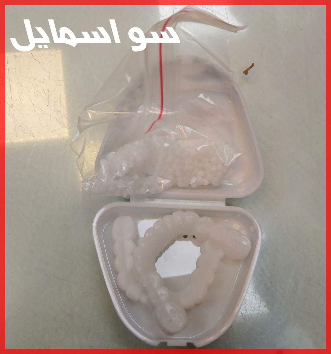 انواع لمینت متحرک دندان آماده با خمیر و قالب گیر|آرایشی، بهداشتی، درمانی|تهران, آرژانتین|دیوار