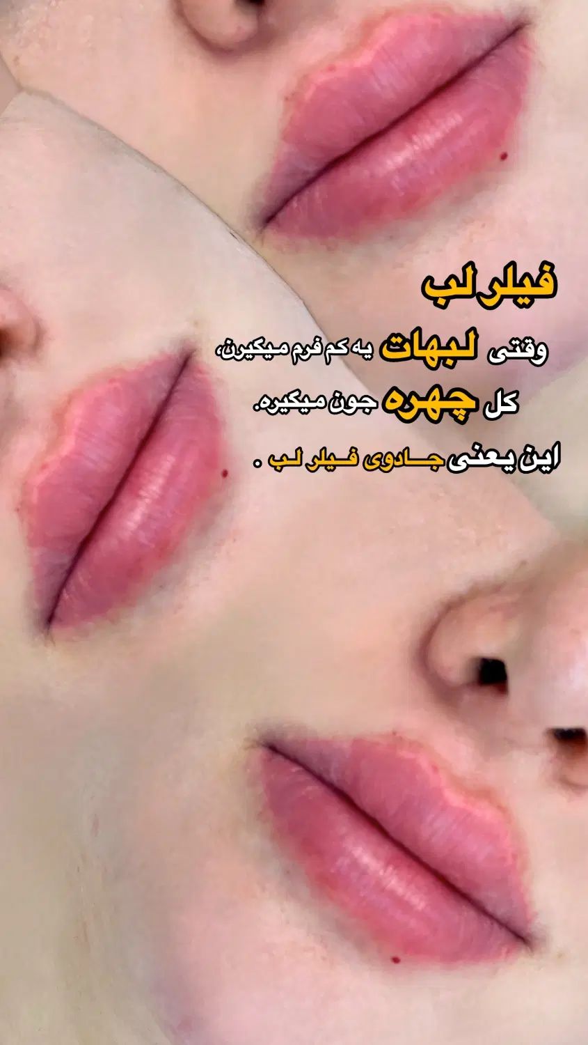 جشنواره زیبایی کلینیک آس|خدمات آرایشگری و زیبایی|تهران, تهرانسر مرکزی|دیوار