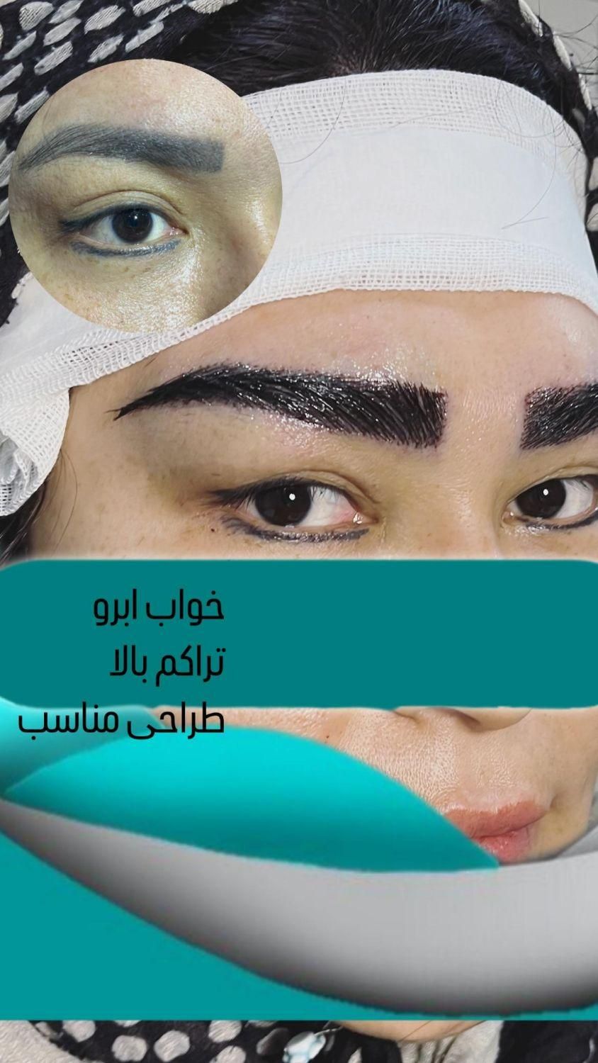 جشنواره کاشت ابرو پرتراکم|خدمات آرایشگری و زیبایی|تهران, زعفرانیه|دیوار