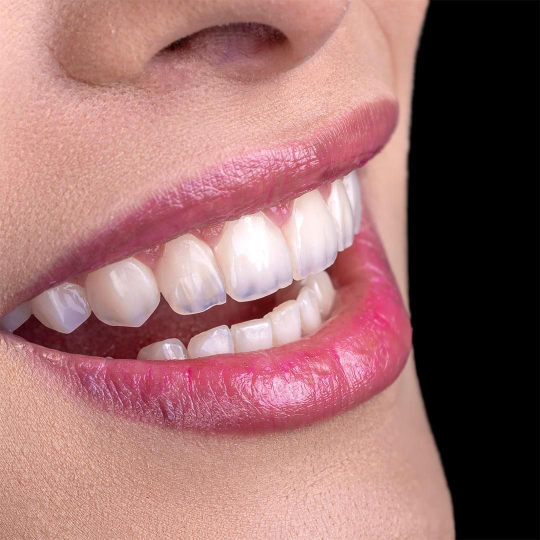 عکاس مطب دندانپزشکی|استخدام هنری و رسانه|تهران, ولنجک|دیوار