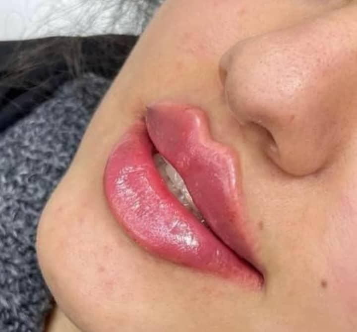 آموزش ژل وبوتاکس2900.چال گونه.آموزش نخ2500.ژل بادی|خدمات آموزشی|اهواز, گلستان|دیوار