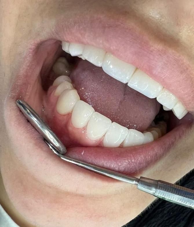 دوره دستیاری/تکنسین دندانپزشک منشی پزشک/کمک بکار|استخدام درمانی، زیبایی، بهداشتی|اصفهان, شاهزید|دیوار